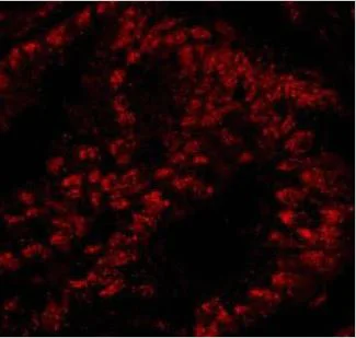 Immunohistochemistry (Frozen sections) - Anti-SART3 antibody (AB176822)