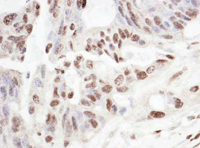 Immunohistochemistry (Frozen sections) - Anti-SART3 antibody (AB176822)