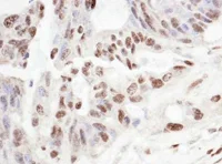 Immunohistochemistry (Frozen sections) - Anti-SART3 antibody (AB176822)
