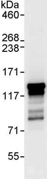 Immunoprecipitation - Anti-SART3 antibody (AB176822)