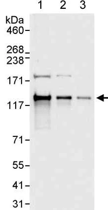 Western blot - Anti-SART3 antibody (AB176822)