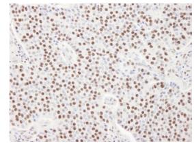 Immunohistochemistry (Formalin/PFA-fixed paraffin-embedded sections) - Anti-SART3 antibody (AB84671)