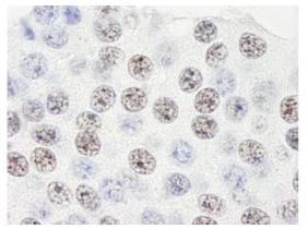 Immunohistochemistry (Formalin/PFA-fixed paraffin-embedded sections) - Anti-SART3 antibody (AB84671)