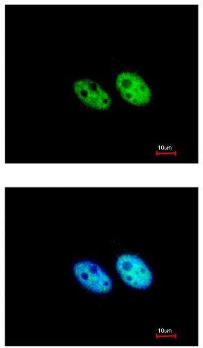 Immunocytochemistry/ Immunofluorescence - Anti-SART3 antibody - C-terminal (AB155765)
