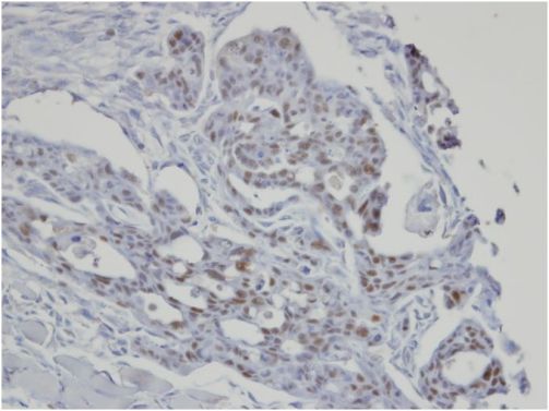 Immunohistochemistry (Formalin/PFA-fixed paraffin-embedded sections) - Anti-SART3 antibody - C-terminal (AB155765)
