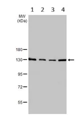 Western blot - Anti-SART3 antibody - C-terminal (AB155765)