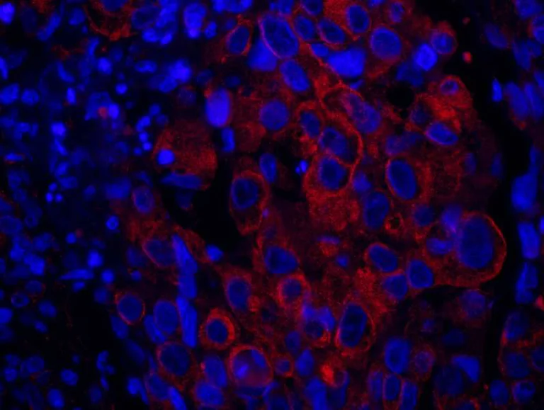 Immunohistochemistry (Formalin/PFA-fixed paraffin-embedded sections) - Anti-SASH1 antibody (AB111901)