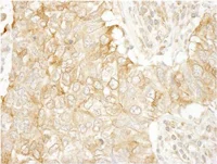 Immunohistochemistry (Formalin/PFA-fixed paraffin-embedded sections) - Anti-SASH1 antibody (AB111901)