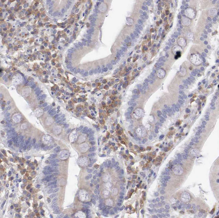 Immunohistochemistry (Formalin/PFA-fixed paraffin-embedded sections) - Anti-SASH3 antibody (AB251656)