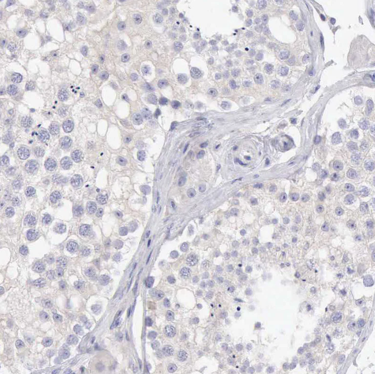 Immunohistochemistry (Formalin/PFA-fixed paraffin-embedded sections) - Anti-SASH3 antibody (AB251656)