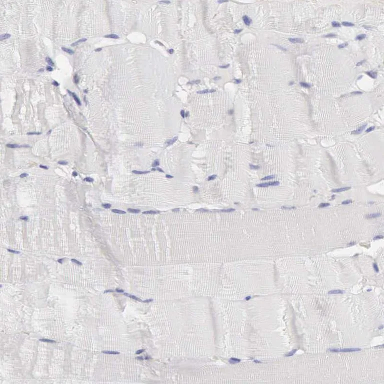 Immunohistochemistry (Formalin/PFA-fixed paraffin-embedded sections) - Anti-SASH3 antibody (AB251656)