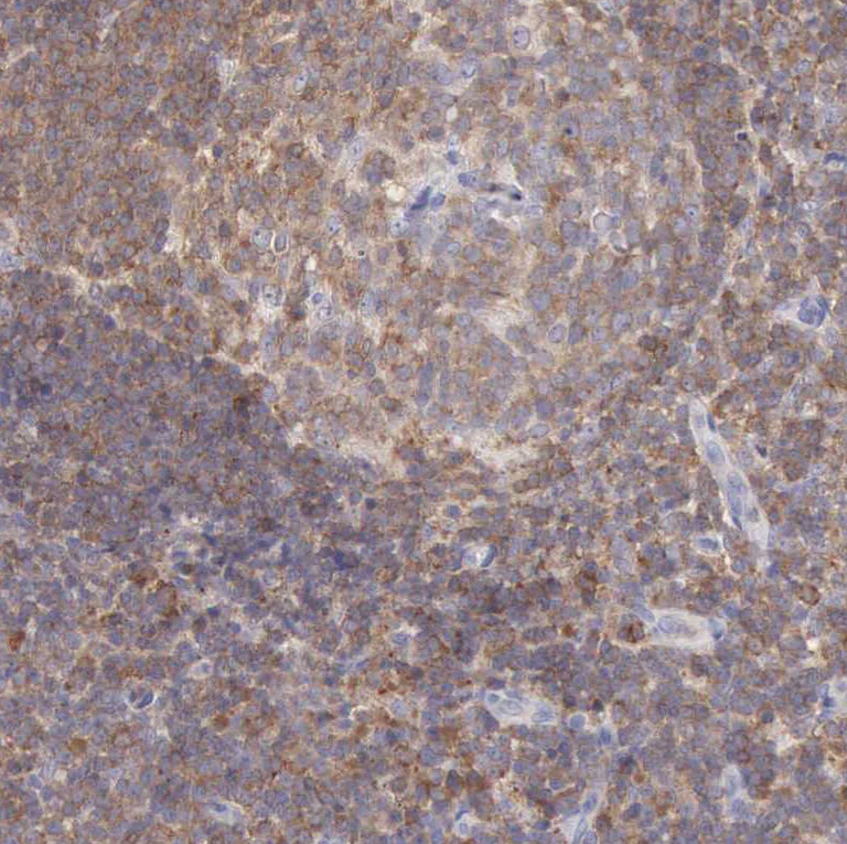 Immunohistochemistry (Formalin/PFA-fixed paraffin-embedded sections) - Anti-SASH3 antibody (AB251656)