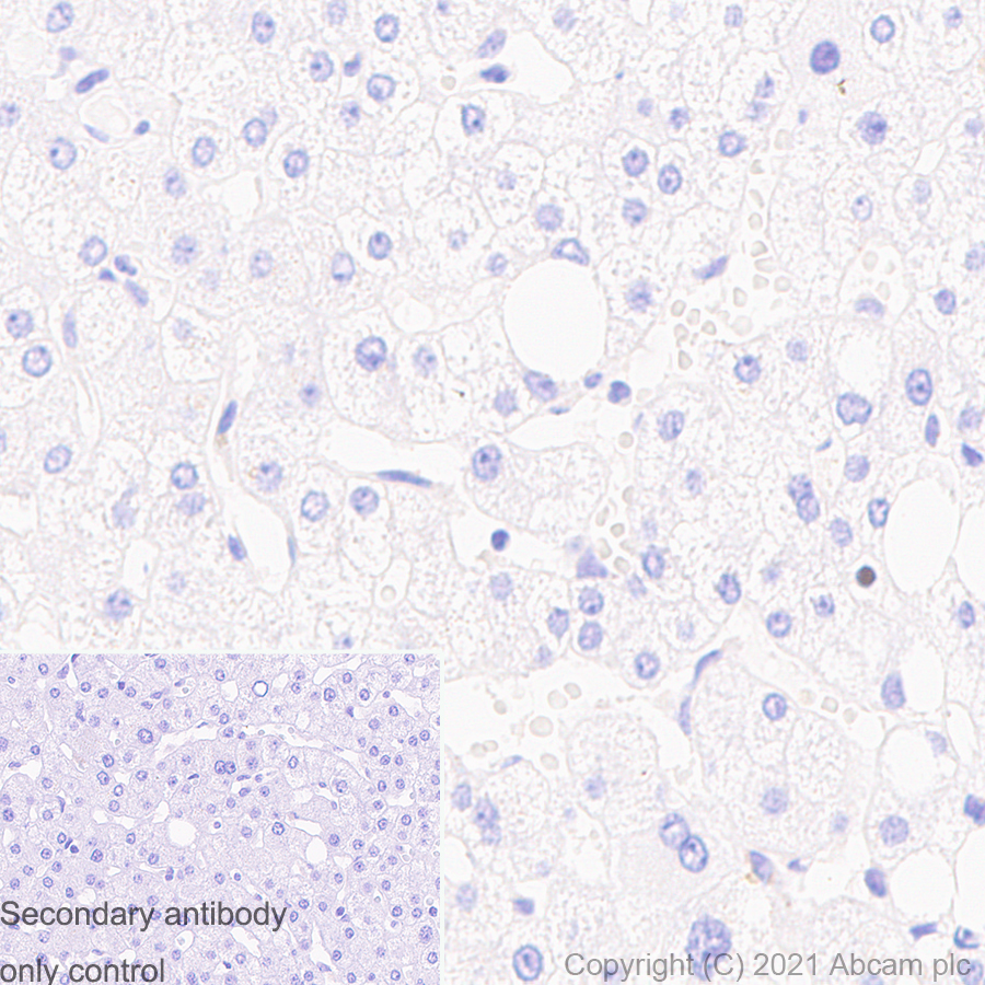 Immunohistochemistry (Formalin/PFA-fixed paraffin-embedded sections) - Anti-SATB1 antibody [14/SATB1] (ab280578), expandable thumbnail