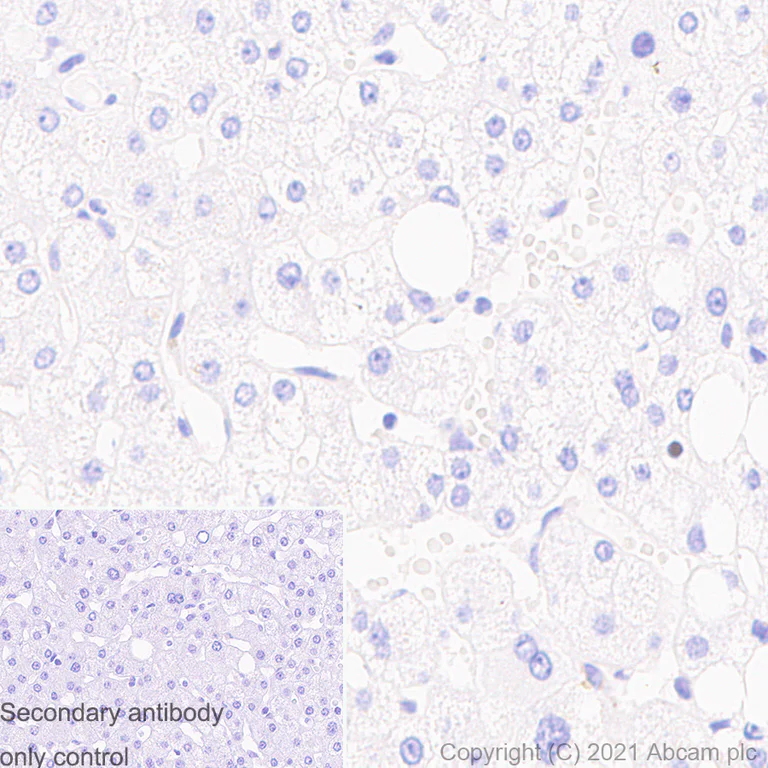 Immunohistochemistry (Formalin/PFA-fixed paraffin-embedded sections) - Anti-SATB1 antibody [14/SATB1] (AB280578)