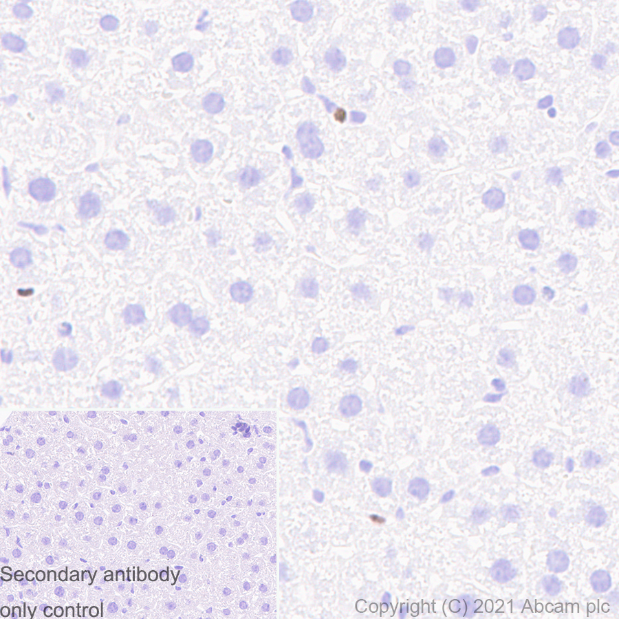Immunohistochemistry (Formalin/PFA-fixed paraffin-embedded sections) - Anti-SATB1 antibody [14/SATB1] (ab280578), expandable thumbnail