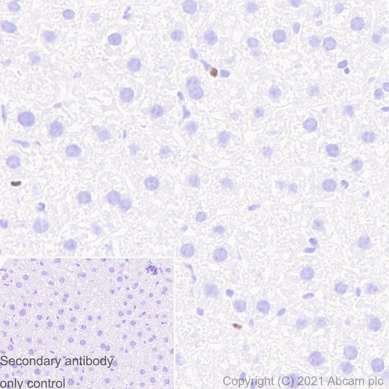 Immunohistochemistry (Formalin/PFA-fixed paraffin-embedded sections) - Anti-SATB1 antibody [14/SATB1] (AB280578)