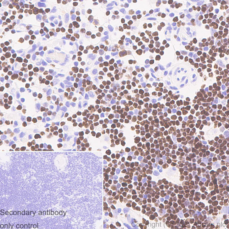 Immunohistochemistry (Formalin/PFA-fixed paraffin-embedded sections) - Anti-SATB1 antibody [14/SATB1] (AB280578)