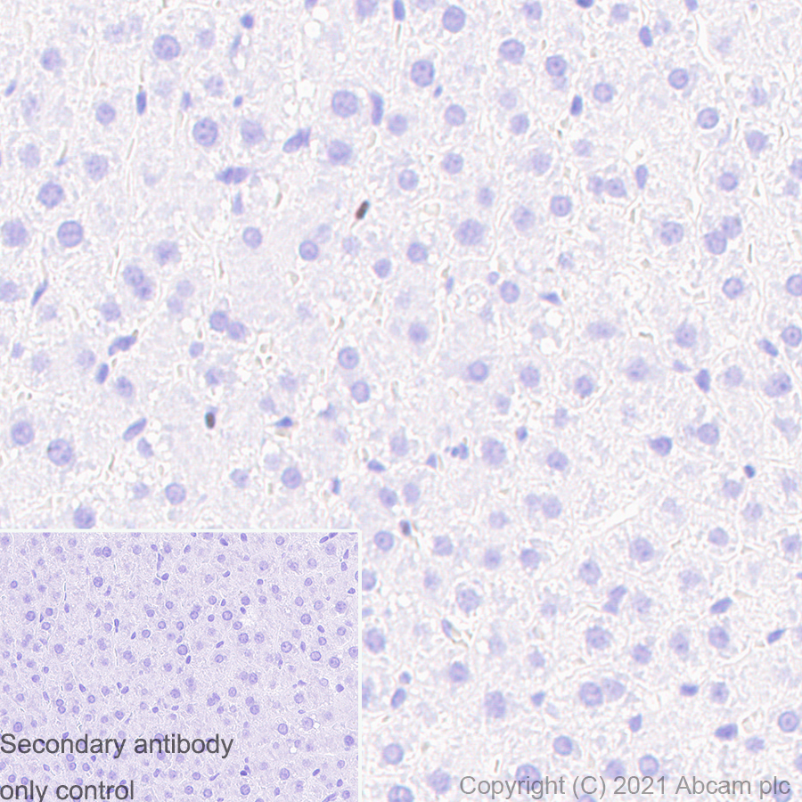 Immunohistochemistry (Formalin/PFA-fixed paraffin-embedded sections) - Anti-SATB1 antibody [14/SATB1] (ab280578), expandable thumbnail