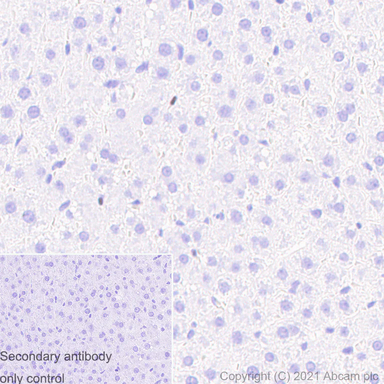 Immunohistochemistry (Formalin/PFA-fixed paraffin-embedded sections) - Anti-SATB1 antibody [14/SATB1] (AB280578)