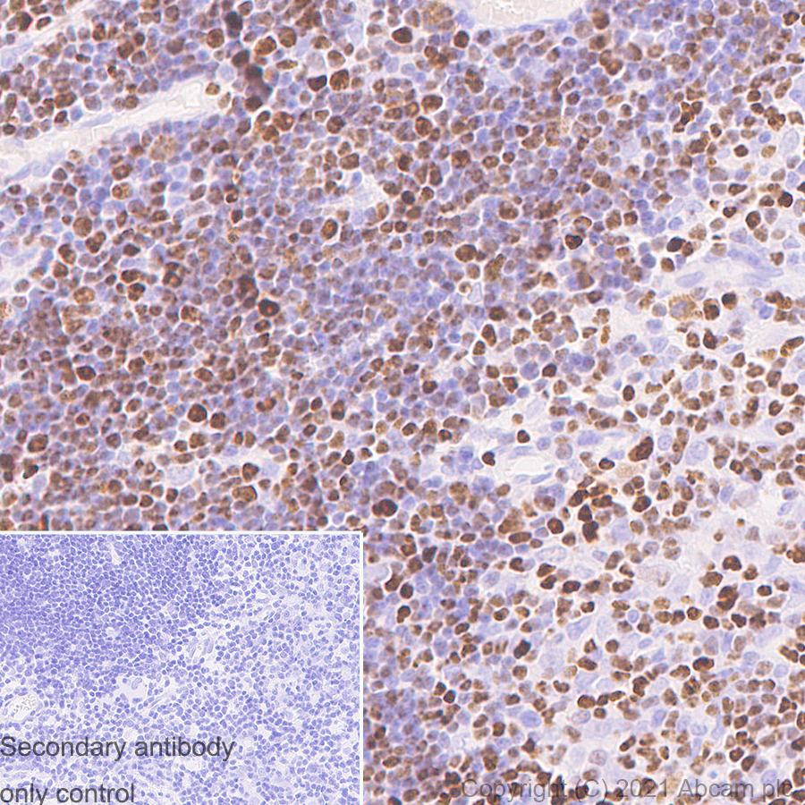 Immunohistochemistry (Formalin/PFA-fixed paraffin-embedded sections) - Anti-SATB1 antibody [14/SATB1] (AB280578), expandable thumbnail