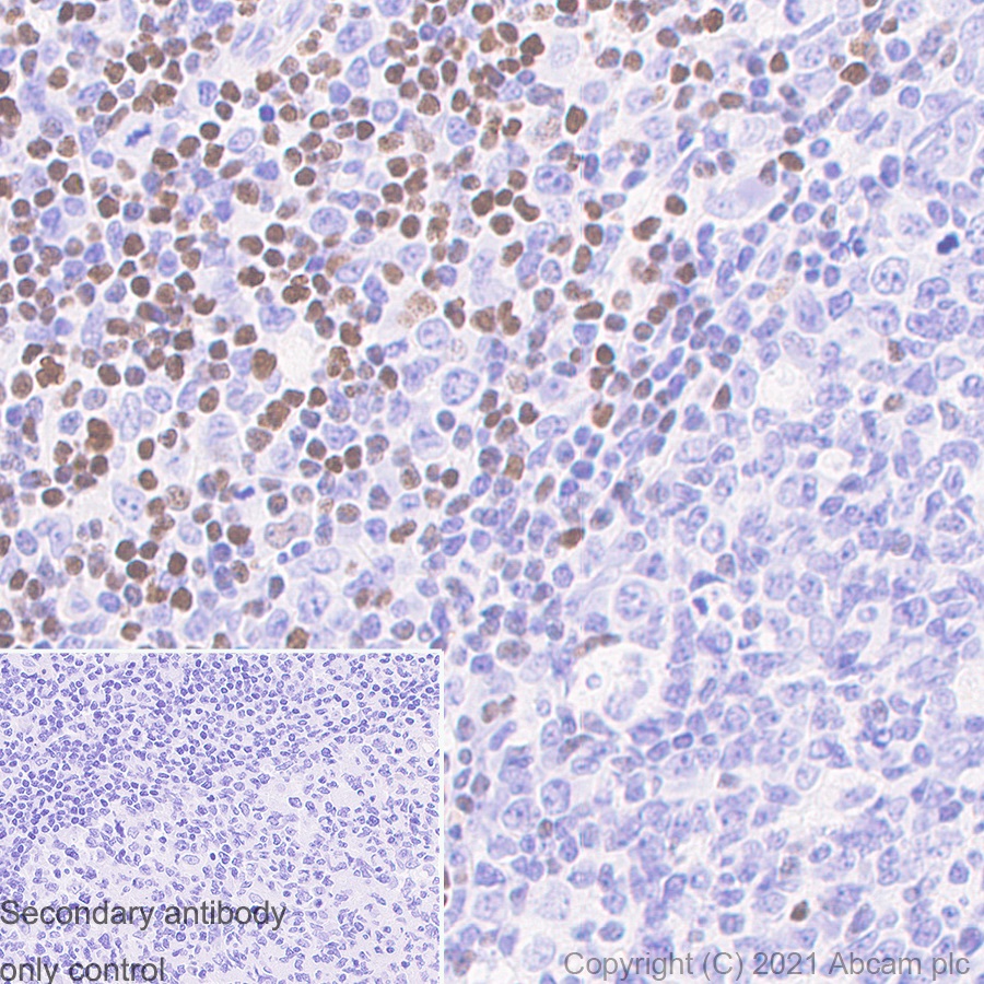 Immunohistochemistry (Formalin/PFA-fixed paraffin-embedded sections) - Anti-SATB1 antibody [14/SATB1] (AB280578), expandable thumbnail