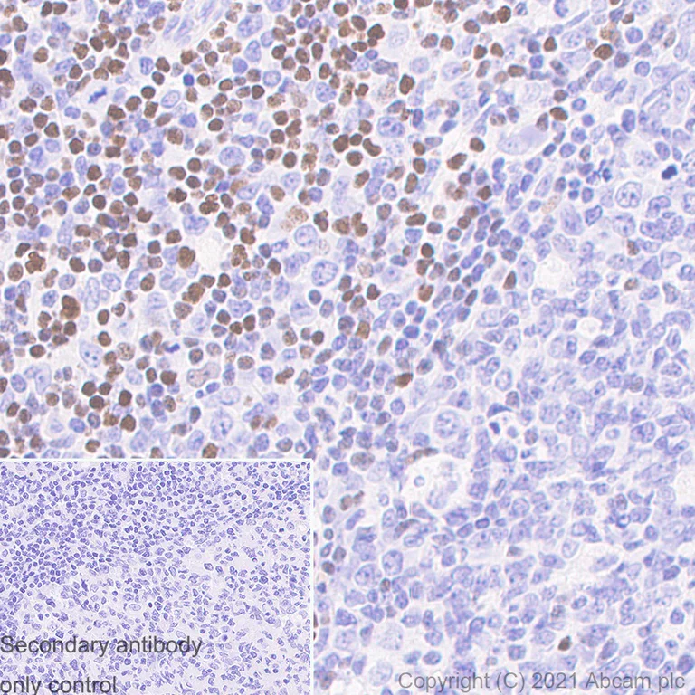 Immunohistochemistry (Formalin/PFA-fixed paraffin-embedded sections) - Anti-SATB1 antibody [14/SATB1] (AB280578)