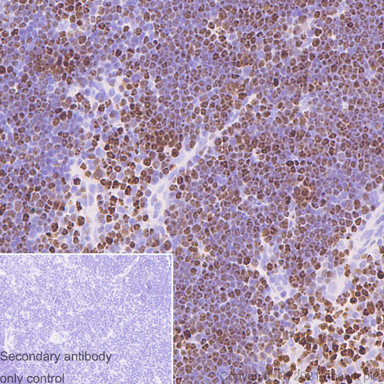 Immunohistochemistry (Formalin/PFA-fixed paraffin-embedded sections) - Anti-SATB1 antibody [14/SATB1] (AB280578)