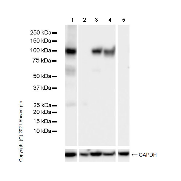 Western blot - Anti-SATB1 antibody [14/SATB1] (AB280578), expandable thumbnail