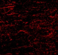 Immunocytochemistry/ Immunofluorescence - Anti-SATB1 antibody (AB70004)