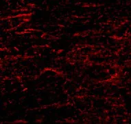 Immunocytochemistry/ Immunofluorescence - Anti-SATB1 antibody (AB70004)