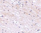 Immunohistochemistry (Formalin/PFA-fixed paraffin-embedded sections) - Anti-SATB1 antibody (AB70004)