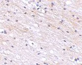 Immunohistochemistry (Formalin/PFA-fixed paraffin-embedded sections) - Anti-SATB1 antibody (AB70004)