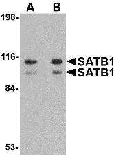 Western blot - Anti-SATB1 antibody (AB70004)