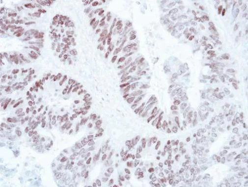 Immunohistochemistry (Formalin/PFA-fixed paraffin-embedded sections) - Anti-SATB1 antibody - C-terminal (AB228772)