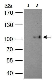 Immunoprecipitation - Anti-SATB1 antibody - C-terminal (AB228772)