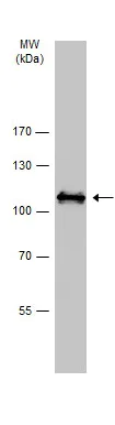 Western blot - Anti-SATB1 antibody - C-terminal (AB228772)