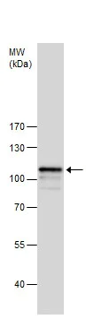Western blot - Anti-SATB1 antibody - C-terminal (AB228772)