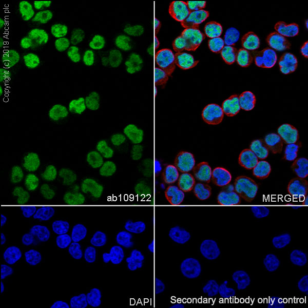 Immunocytochemistry/ Immunofluorescence - Anti-SATB1 antibody [EPR3951] (AB109122)