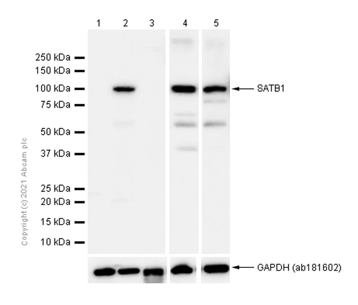 Western blot - Anti-SATB1 antibody [EPR3951] (AB109122)