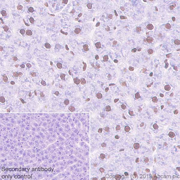 Immunohistochemistry (Formalin/PFA-fixed paraffin-embedded sections) - Anti-SATB1 antibody [EPR3951] - BSA and Azide free (AB239944)