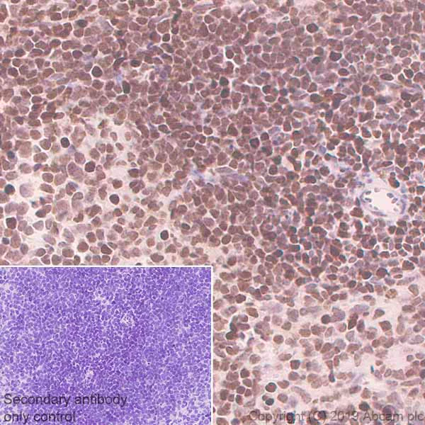 Immunohistochemistry (Formalin/PFA-fixed paraffin-embedded sections) - Anti-SATB1 antibody [EPR3951] - BSA and Azide free (AB239944)