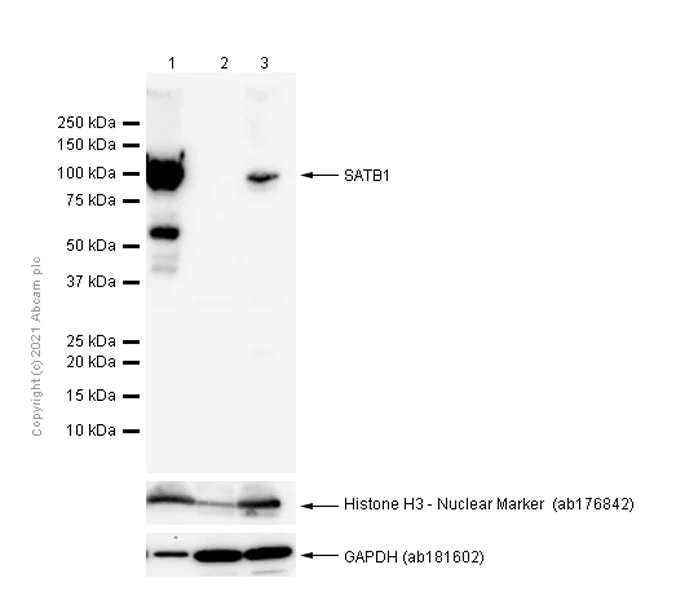 Western blot - Anti-SATB1 antibody [EPR3951] - BSA and Azide free (AB239944)