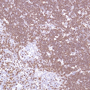 Immunohistochemistry (Formalin/PFA-fixed paraffin-embedded sections) - Anti-SATB1 antibody [SP280] - C-terminal (AB227685), expandable thumbnail