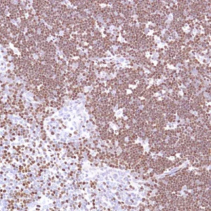 Immunohistochemistry (Formalin/PFA-fixed paraffin-embedded sections) - Anti-SATB1 antibody [SP280] - C-terminal (AB227685)