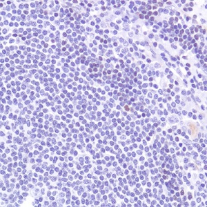 Immunohistochemistry (Formalin/PFA-fixed paraffin-embedded sections) - Anti-SATB1 antibody [SP280] - C-terminal (AB227685), expandable thumbnail