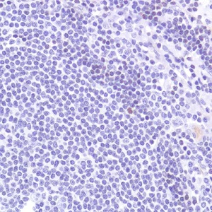 Immunohistochemistry (Formalin/PFA-fixed paraffin-embedded sections) - Anti-SATB1 antibody [SP280] - C-terminal (AB227685)