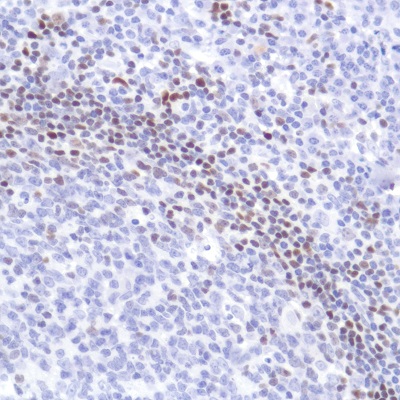 Immunohistochemistry (Formalin/PFA-fixed paraffin-embedded sections) - Anti-SATB1 antibody [SP287] - BSA and Azide free (AB272006), expandable thumbnail