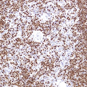 Immunohistochemistry (Formalin/PFA-fixed paraffin-embedded sections) - Anti-SATB1 antibody [SP287] - BSA and Azide free (AB272006)