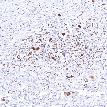 Immunohistochemistry (Formalin/PFA-fixed paraffin-embedded sections) - Anti-SATB1 antibody [SP287] - BSA and Azide free (AB272006)
