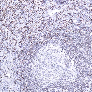 Immunohistochemistry (Formalin/PFA-fixed paraffin-embedded sections) - Anti-SATB1 antibody [SP287] - C-terminal (AB226834)
